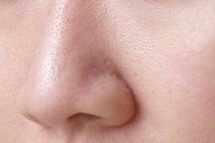 طرق التخلص من مسامات الأنف الواسعة: حلول فعّالة لتقليل مظهرها
